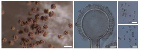 Aspergillus dhakephalkarii